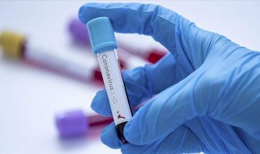 बिहार में 2082 नये कोरोना पेसेंट मिले, स्टेट में संक्रमितों की संख्या 48001 पहुंची, 296 की मौत