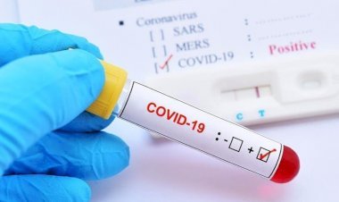 झारखंड में 10 अगस्त को 612 नये कोरोना पेसेंट मिले, संक्रमितों की संख्या 18,857 पहुंची