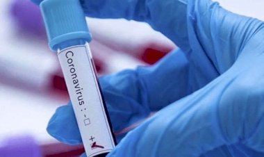 झारखंड में 940 नये कोरोना पेसेंट मिले, 15 की मौत, स्टेट में संक्रमितों की संख्या 31118 हुई