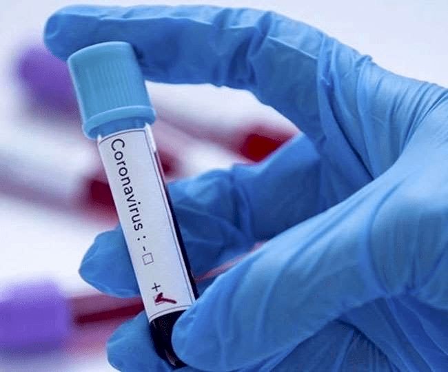 झारखंड में 940 नये कोरोना पेसेंट मिले, 15 की मौत, स्टेट में संक्रमितों की संख्या 31118 हुई