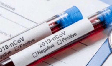 झारखंड में 11 सितंबर को 961 कोरोना पॉजिटिव मिले, स्टेट में संक्रमितों की संख्या 59040 हुई