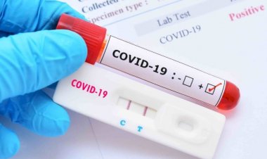 धनबाद में 25 सितंबर को 88 नये कोरोना पेसेंट मिले, स्पेशल आरएटी ड्राइव में 26 संक्रमित पाये गये