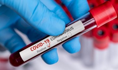 धनबाद: 27 सितंबर को 32 नये कोरोना पेसेंट मिले, जिले में संक्रमितों की संख्या 4972 पहुंची, प्लाज्मा डोनेट करने के लिए वेबसाइट डेवलप