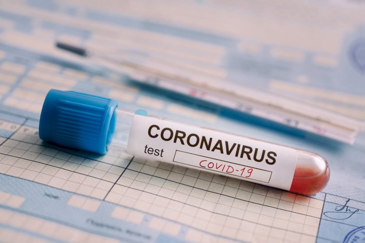 धनबाद: 19 सितंबर को मिले 74 कोरोना पॉजिटिव, जिले में  संक्रमितों की संख्या 4421 हुई