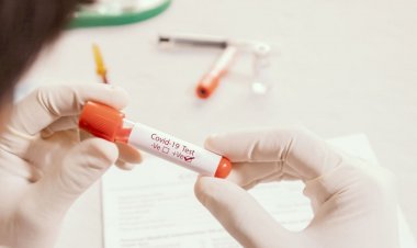 झारखंड में दो अक्टूबर को 736 कोरोना पॉजिटिव मिले, आठ की मौत, स्टेट में संक्रमितों की संख्या 85400 पहुंची