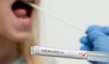 धनबाद में 12 नवंबर को 43 कोरोना पॉजिटिव मिले, जिले में संक्रमितों की संख्या 6739 पहुंची