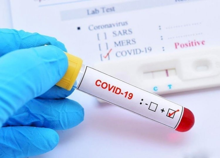धनबाद में तीन नवंबर को 39 कोरोना पॉजिटिव मिले, जिले में संक्रमितों की संख्या 6462 हुई
