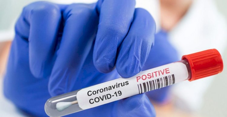 धनबाद में 16 नवंबर को 12 कोरोना पॉजिटिव मिले, जिले में संक्रमितों की संख्या 6798 हुई