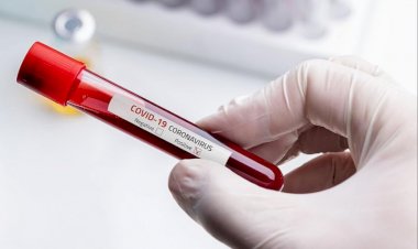 धनबाद में 17 दिसंबर को चार कोरोना पॉजिटिव मिले, जिले में संक्रमितों की संख्या 7246 पहुंची