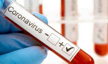 झारखंड में दो अप्रैल को 694 नये कोरोना पॉजिटिव मिले, रांची में 368 नये केस, स्टेट में संक्रमितों की संख्या 125585 पहुंची