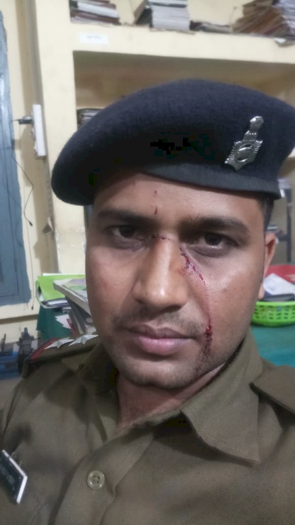 धनबाद:जोड़ापोखर में सीआरपीएफ कांस्टेबल ने पुलिस सब इंस्पेक्टर से की मारपीट,आरोपी के खिलाफ FIR, पुलिस स्टेशन से बेल