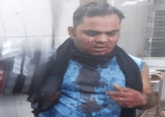 जमशेदपुर: उलीडीह में क्रिमिनलों ने ज्वेलरी बिजनसमैन को मारी गोली, पुलिस ने नहीं लिया था कंपलेन