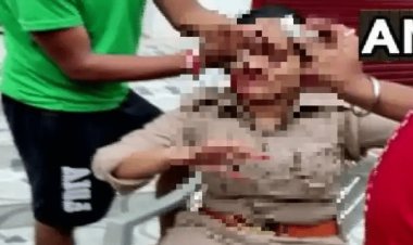 उत्तर प्रदेश: लखनऊ में  ड्यूटी कर रही महिला कांस्टेबल से छेड़छाड़, विरोध करने पर युवक ने सिर फोड़ा