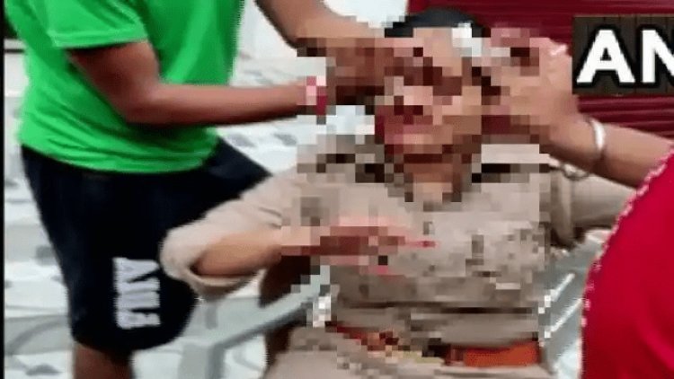 उत्तर प्रदेश: लखनऊ में ड्यूटी कर रही महिला कांस्टेबल से छेड़छाड़, विरोध करने पर युवक ने सिर फोड़ा