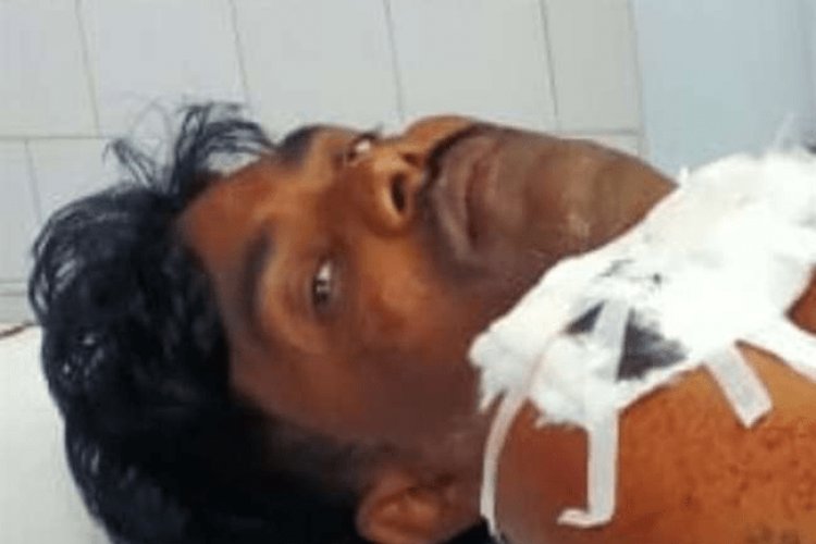 पलामू:पतंजलि की एजेंसी के सेल्समैन को गोली मारी