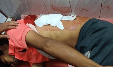 Dhanbad :  चासनाला में रिकवरी एजेंट को गोली मार पांच लाख रुपये की  लूट 