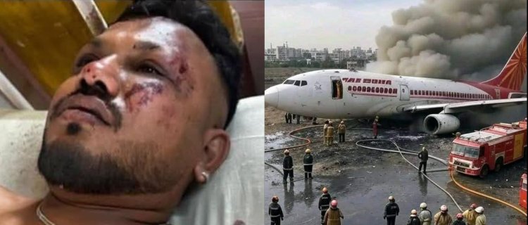 Ahmedabad Plane Crash : अहमदाबाद विमान हादसे में जिंदा बचा एक पैसेंजर, 241 की मौत