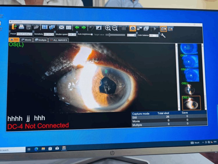 धनबाद: BCCL सेंट्रल हॉस्पिटल के डॉक्टरों ने कर दिखाया कमाल – तीन साल बाद मीना देवी को फिर मिली 6/6 नजर