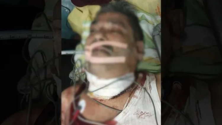 धनबाद में कोयला कारोबारी को लगी गोली, घर में चली लाइसेंसी पिस्टल; आईसीयू में जिंदगी-मौत से जूझ रहे दीपक शर्मा